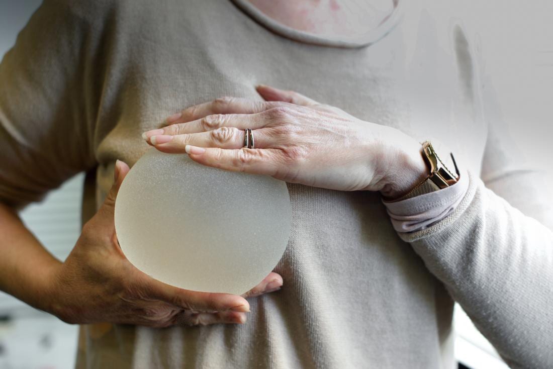 woman holding a breast implant