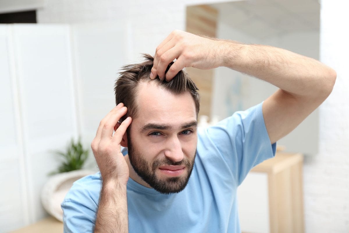 a man checking his hair loss