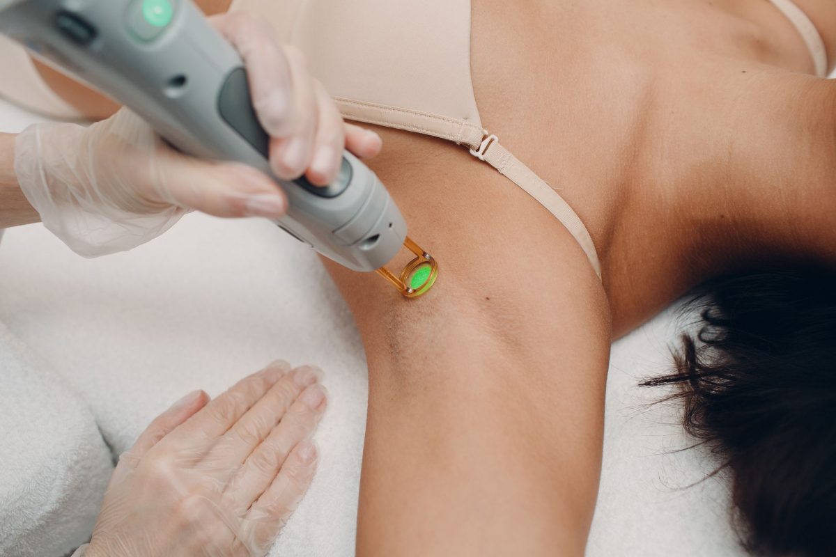 a woman receiving laser hair removal