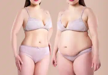 an image of a woman before and after a tummy tuck